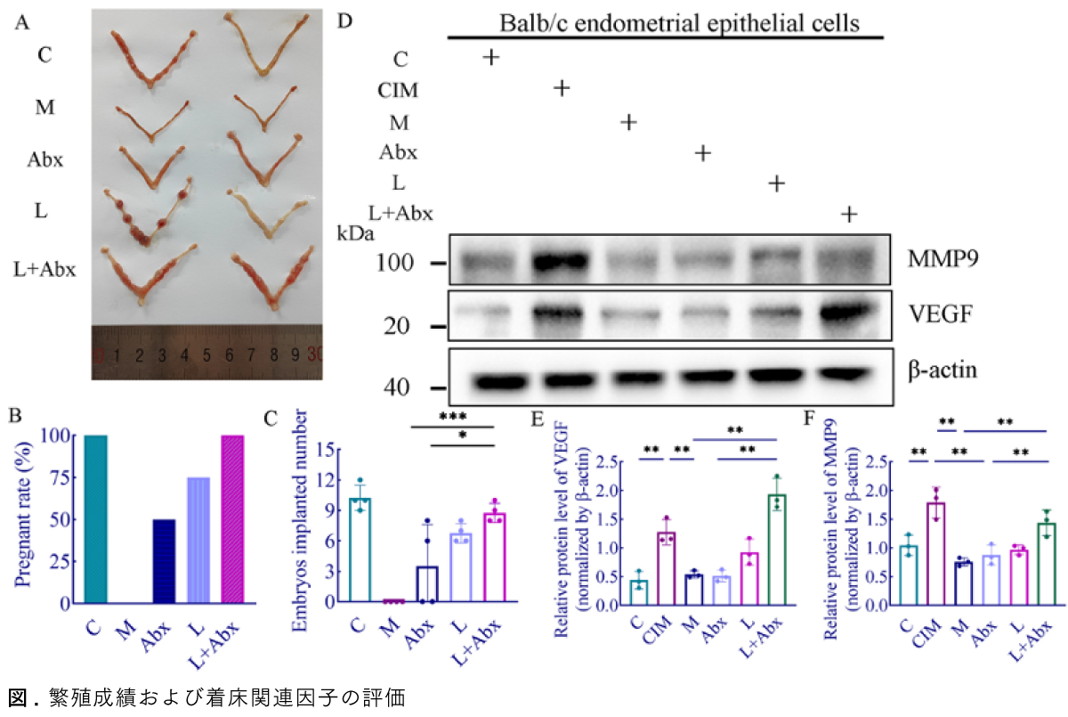 Graphical Abstract 慢性子宮内膜炎に対する乳酸菌クリスパタスの治療可能性： 包括的臨床試験と実験的研究